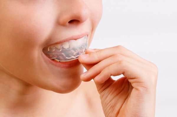 Tác dụng của dụng cụ chống nghiến răng là gì?