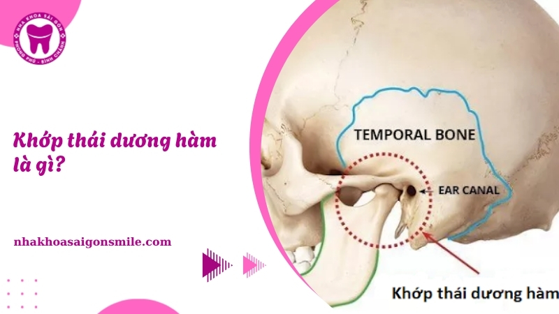 208. Khop thai duong ham la gi Dau hieu nguyen nhan va cach chua