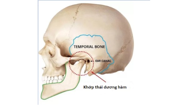 Khớp thái dương hàm là khớp nối giữa xương hàm dưới