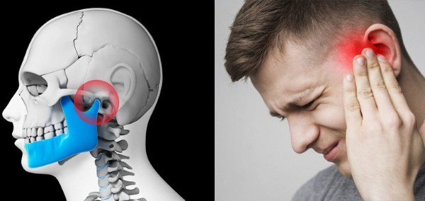 Triệu chứng và dấu hiệu nhận biết bị khớp thái dương hàm