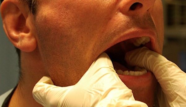 Cách điều trị khớp thái dương hàm hiệu quả