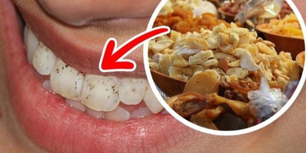 Ăn quá nhiều thực phẩm chứa nhiều tinh bột và đường
