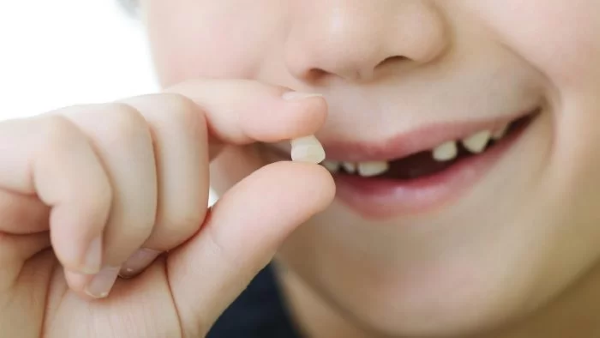 Nhổ răng khi răng sữa bị sâu không cong khả năng phục hồi