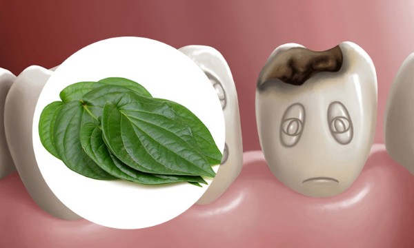 Sử dụng lá trầu không làm sạch và cải thiện tình trạng răng sữa bị sâu