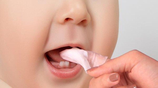 Vệ sinh răng miệng cho bé chưa đúng cách dẫn đến răng sữa bị sâu