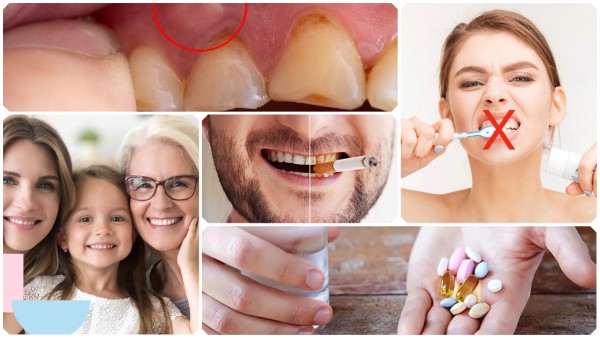 Các nguyên nhân gây ra tình trạng răng vàng