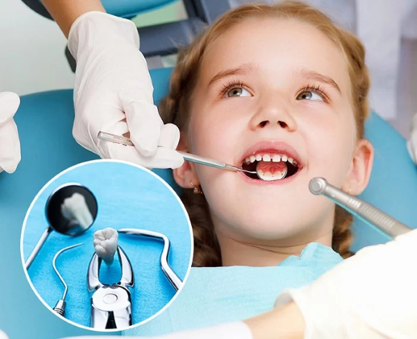 Nhổ răng là cách chữa sâu răng cho trẻ 4 tuổi bắt buộc phải dùng khi răng bi sâu nghiêm trọng