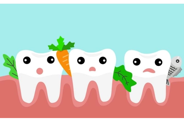 Thức ăn mắc kẹt gây vi khuẩn phát triển