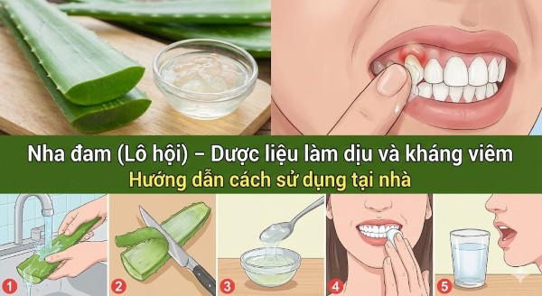 Nha đam (Lô hội) – "Dược liệu" làm dịu và kháng viêm lành tính Nha đam (Lô hội) – "Dược liệu" làm dịu và kháng viêm lành tính