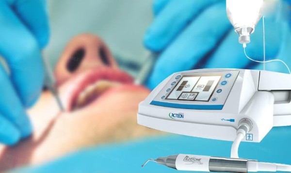 Các kỹ thuật hỗ trợ quá trình nhổ răng hàm trên trong cùng bị sâu tại Nha Khoa Sài Gòn