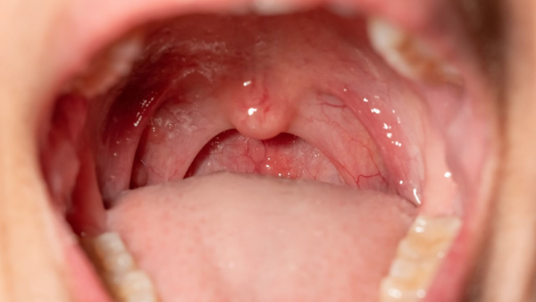 Niêm mạc là gì? Cấu tạo, chức năng, bệnh lý và cách chăm sóc hiệu quả 1 Tổng quan về niêm mạc là gì