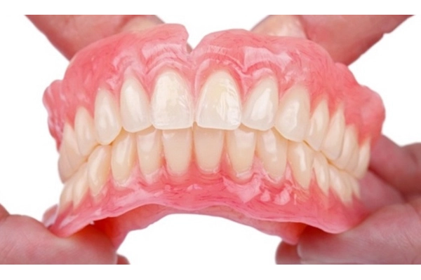 Các loại răng cửa