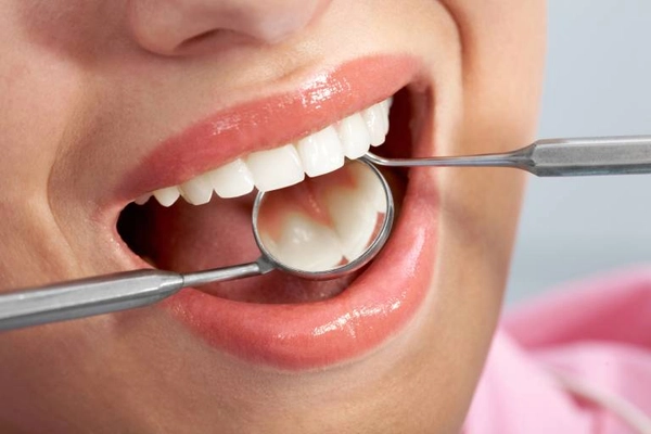 Các phương pháp điều trị và phòng ngừa tại nha khoa