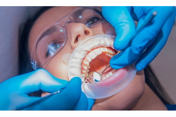 Quy trình trám răng sâu và lấy tủy tại Nha Khoa Sài Gòn