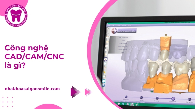 Công nghệ CAD/CAM/CNC là gì? Nguyên lý và ứng dụng hiện nay