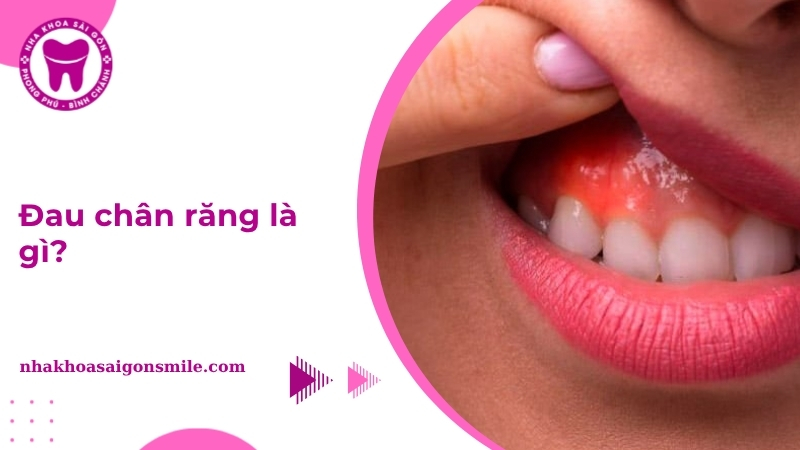 Đau chân răng là gì? Nguyên nhân và cách điều trị hiệu quả