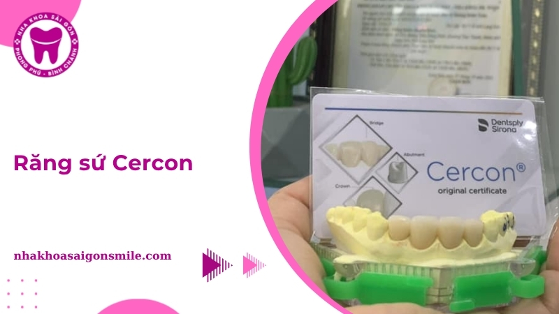 Răng sứ Cercon: Ưu nhược điểm, tuổi thọ và cách chăm sóc