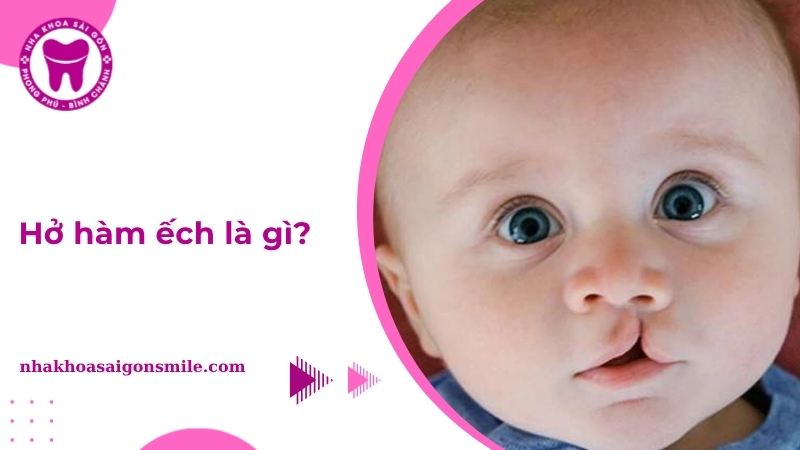 239. Ho ham ech la gi Nguyen nhan trieu chung va cach nhan biet