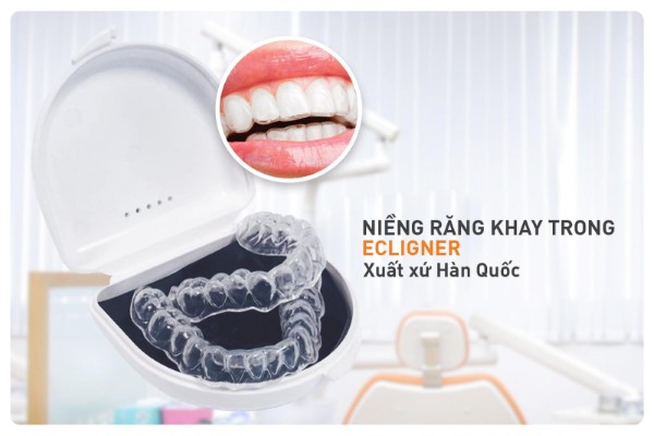 Niềng răng không mắc cài là gì? Ưu nhược điểm & quy trình chi tiết 16 Niềng răng Ecligner