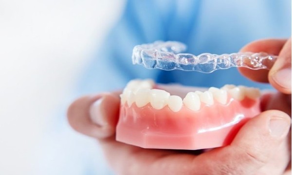 Niềng răng không mắc cài là gì? Ưu nhược điểm & quy trình chi tiết 19 Nhược điểm và lưu ý khi niềng răng không mắc cài