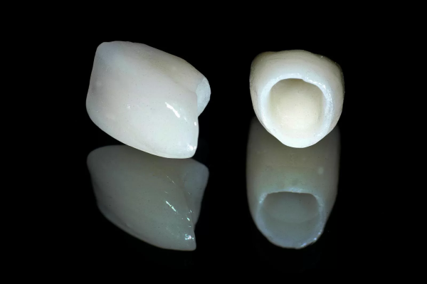 Răng sứ Zirconia nguyên khối