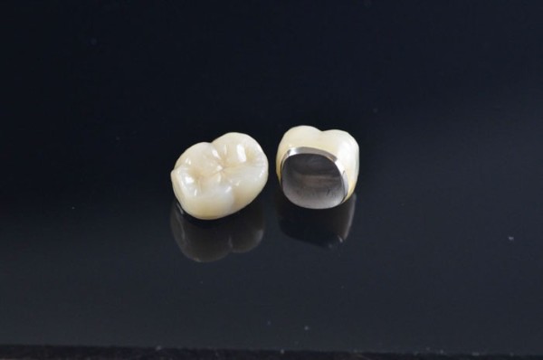 Răng sứ Zirconia sườn kim loại