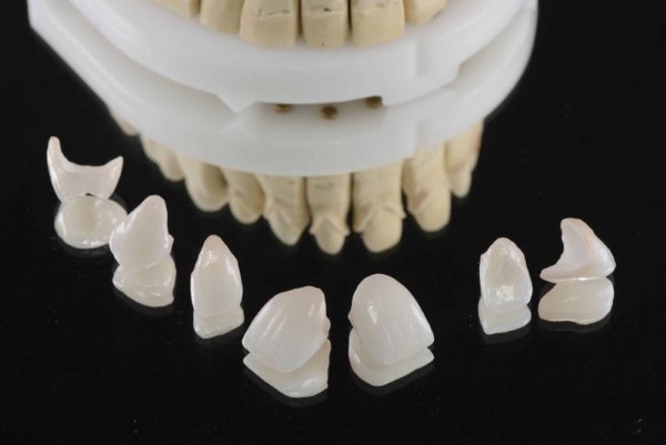 Ưu và nhược điểm của răng sứ zirconia 