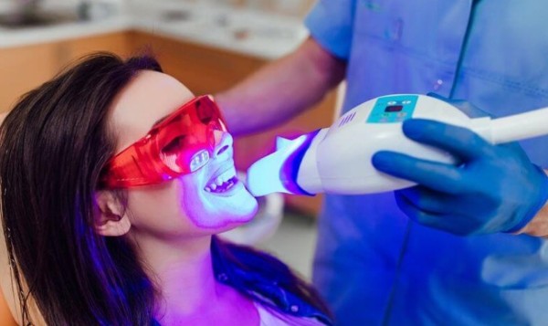 Tẩy trắng răng bao nhiêu tiền? Bảng giá chi tiết cập nhật 11 Làm trắng răng bằng tia laser tai nha khoa