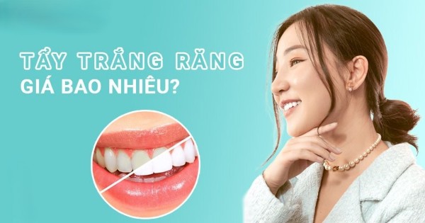 Tẩy trắng răng bao nhiêu tiền? Bảng giá chi tiết cập nhật 12 Tẩy trắng răng bao nhiêu tiền?