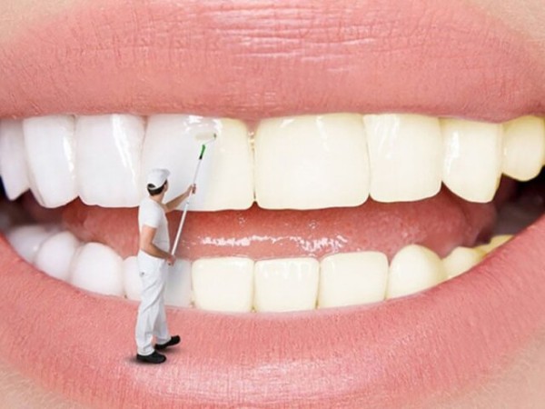 Tẩy trắng răng bao nhiêu tiền? Bảng giá chi tiết cập nhật 14 Các câu hỏi thường gặp về tẩy trắng răng