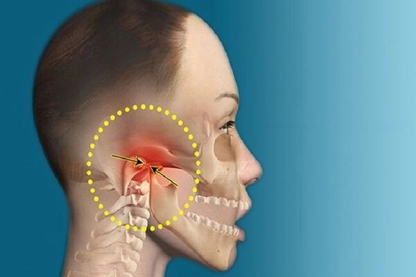 Bị đau quai hàm gần tai bên trái là gì?