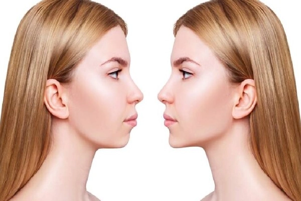 Jawline là gì? Jawline là gì?