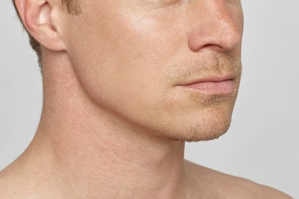 Tập luyện bao lâu thì có đường hàm jawline đẹp? Tập luyện bao lâu thì có đường hàm jawline đẹp?