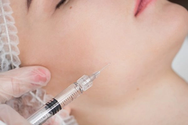 Tiêm filler định hình đường viền hàm Tiêm filler định hình đường viền hàm