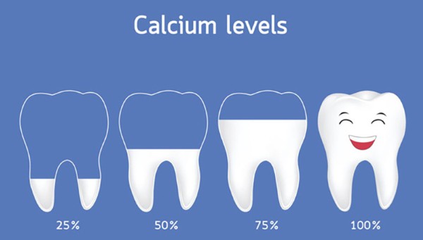 Niềng răng móm là gì? Quy trình, chi phí và hiệu quả chỉnh nha 19 Thiếu canxi và khoáng chất cũng dẫn đến tình trạng răng móm