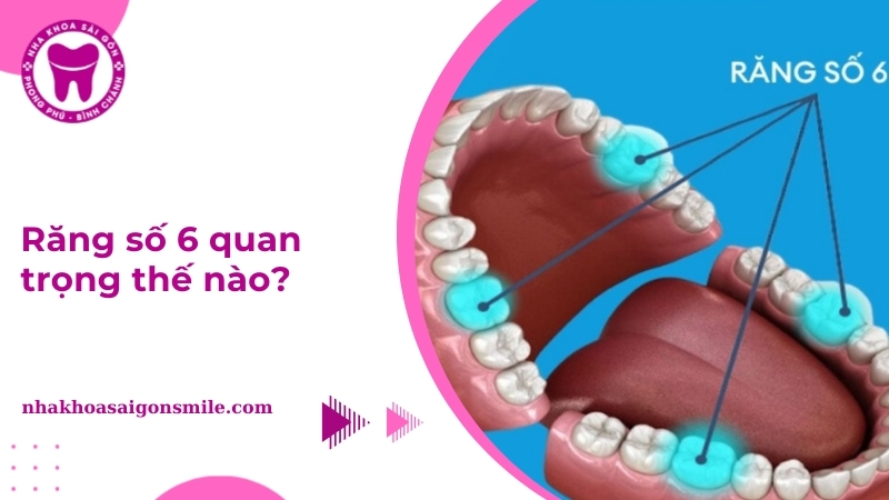 Mất răng số 6: Nguyên nhân, hậu quả và cách phục hồi hiệu quả