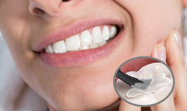 10+ Cách trị ê buốt răng hiệu quả tức thì tại nhà và điều trị dứt điểm 9 Trám răng sâu giúp phục hồi chức năng của răng và giảm ê buốt kéo dài