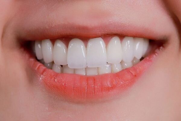 Tại sao số lượng răng của mỗi người khác nhau? Tại sao số lượng răng của mỗi người khác nhau?