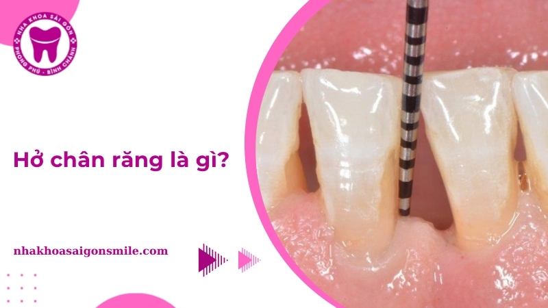 ho chan rang thumbnail