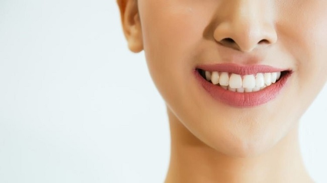 Hô xương ổ răng là gì? Nguyên nhân và cách điều trị hiệu quả 2 Dấu hiệu nhận biết hô xương ổ răng