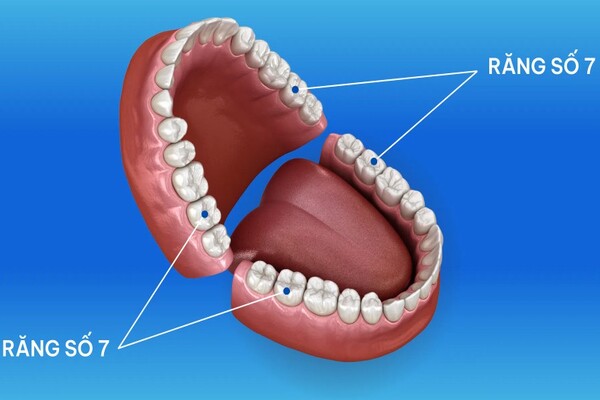 Răng số 7 là gì? Răng số 7 là gì?