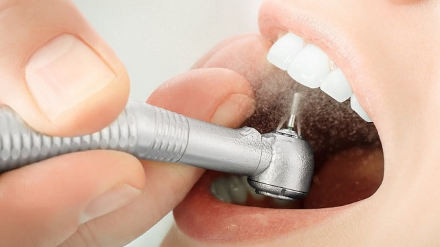 Răng chó là răng gì? Tính cách, vận mệnh và tướng số của người răng chó 7 Mài răng