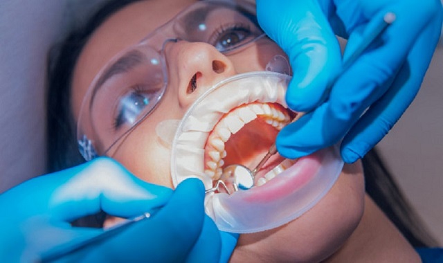 Răng lung lay: Nguyên nhân, dấu hiệu và cách điều trị hiệu quả 11 Chi phí điều trị răng lung lay tùy thuộc vào nguyên nhân, mức độ tổn thương