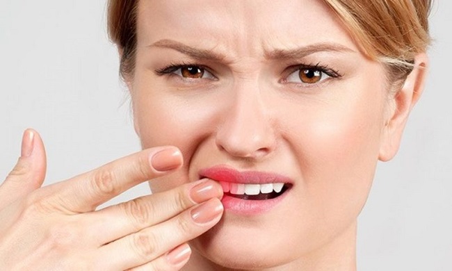 Răng lung lay: Nguyên nhân, dấu hiệu và cách điều trị hiệu quả 6 Chấn thương - Nguyên nhân cơ học gây lung lay răng