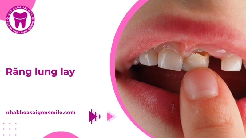 rang lung lay thumbnail