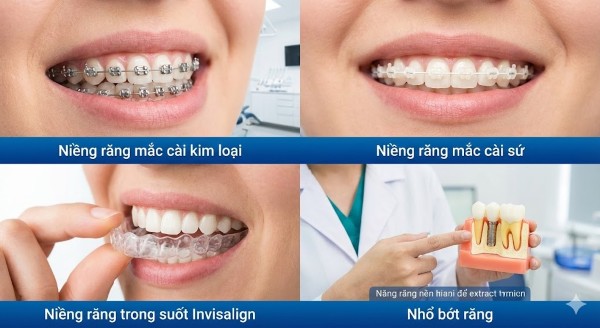 Phương pháp niềng răng Phương pháp niềng răng