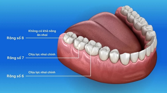 Bọc sứ răng hàm: Nên chọn loại nào để ăn nhai tốt? 1 Răng hàm