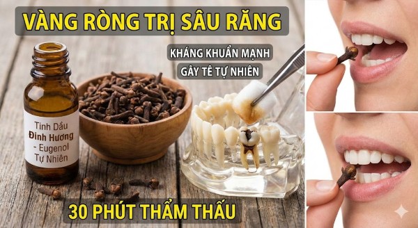 Sử dụng tinh dầu hoặc nụ đinh hương Sử dụng tinh dầu hoặc nụ đinh hương