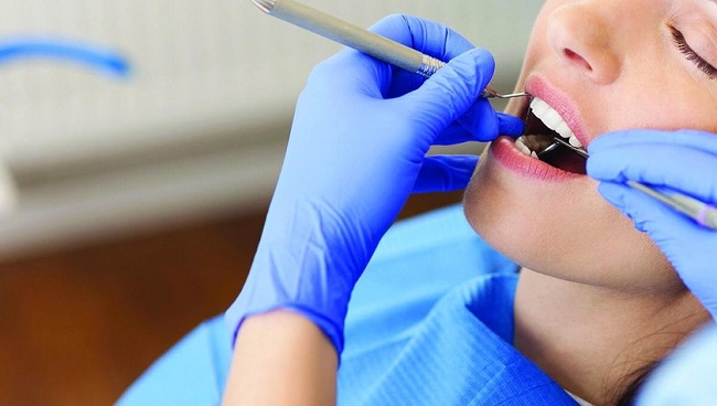 Mài kẽ răng là gì? Kỹ thuật IPR có thực sự an toàn khi niềng răng? 5 Lịch tái khám sau mài kẽ răng