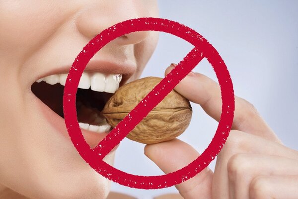 Thun tách kẽ răng: Đeo trong bao lâu và cách giảm đau 5 Tránh những thực phẩm dễ làm rơi thun tách kẽ răng